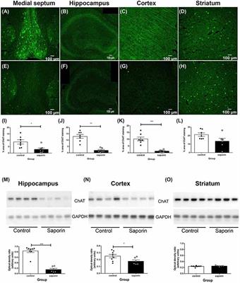 3D Reconstruction of the Neurovascular Unit Reveals Differential Loss of Cholinergic Innervation in the Cortex and Hippocampus of the Adult Mouse Brain